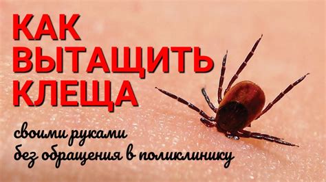 Как удалять клеща дома безопасно: Топ 5 способов