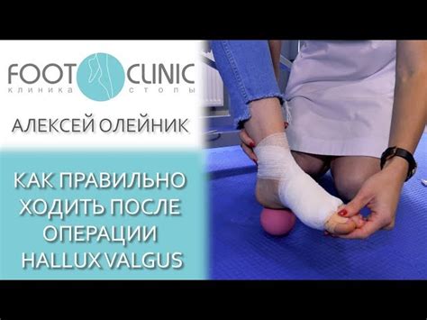 Как устранить отек на ноге после ушиба: эффективные методы припухлости