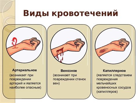 Как эффективно остановить кровотечение после выскабливания: основные правила