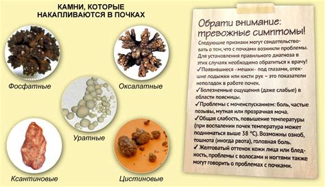 Камни в медицине: лечение и эзотерика