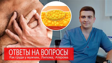 Контактный дерматит как причина зуда на груди у мужчин