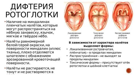 Красное горло: 7 способов