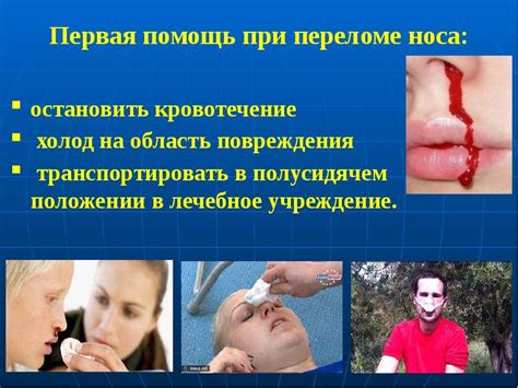 Кровотечение при переломе носа