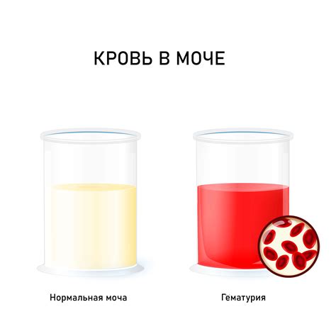 Кровь в моче у котов: основные методы лечения