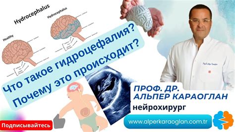 Лечение водянки головы у ребенка: основные подходы