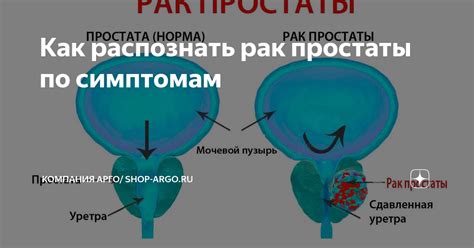 Лечение повышенного содержания железа у мужчин