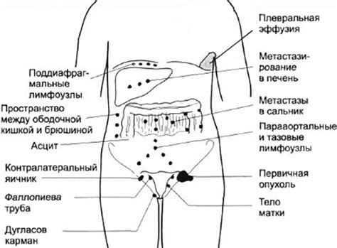 Локальные инфекционные заболевания как фактор увеличения лимфоузла в паху у женщин