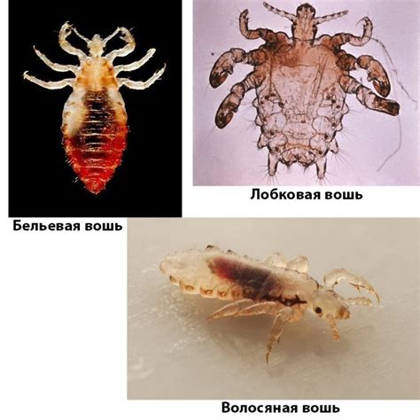Лучшие методы избавления от вшей без вреда для здоровья