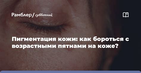 Лучшие способы борьбы с возрастными пятнами на щеках