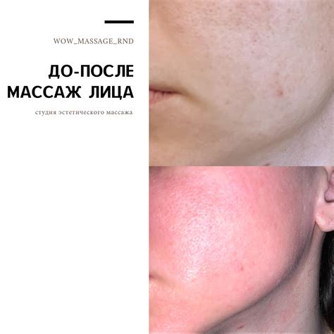 Массаж точек лица: стимуляция кровообращения и улучшение цвета кожи