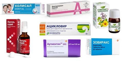 Медикаментозное лечение стоматита у детей и преимущества его применения