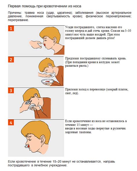 Медицинские методы остановки кровотечения из носа у ребенка