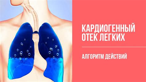 Медицинские состояния, вызывающие односторонний отек