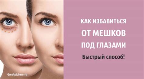 Мезотерапия - безопасный и эффективный способ избавления от мешков под глазами