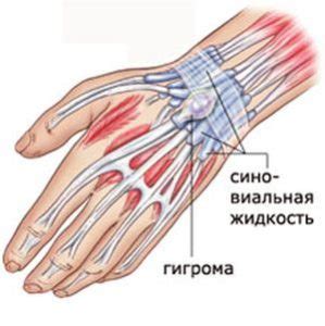Методы восстановления лучезапястного сустава