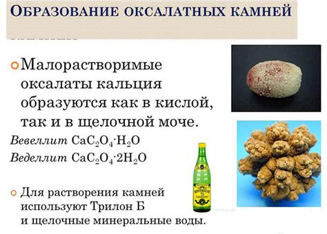 Методы диагностики камней в почках