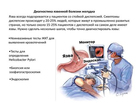 Методы лечения и профилактики язвы при нервном стрессе