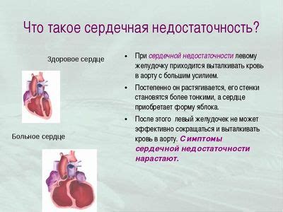 Методы лечения пониженного давления при сердечной недостаточности