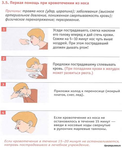 Методы остановки кровотечения из носа у ребенка