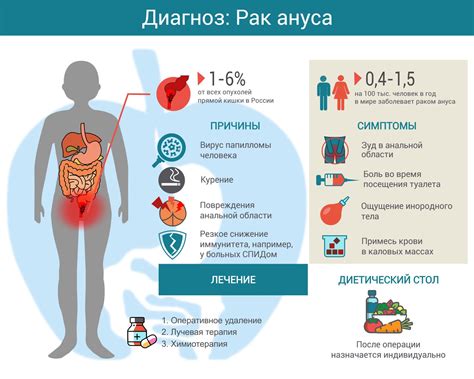Методы очистки ануса: гигиена и рекомендации