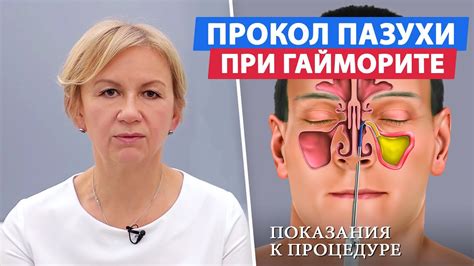 Методы самостоятельной очистки пазух
