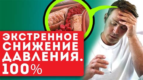 Методы снижения артериального давления без лекарств