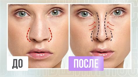 Метод 4: Самомассаж носа для уменьшения объема