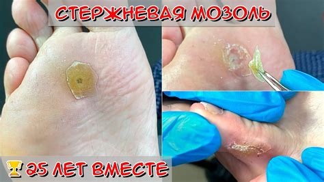 Механическое удаление стыков с помощью ножа или лопатки