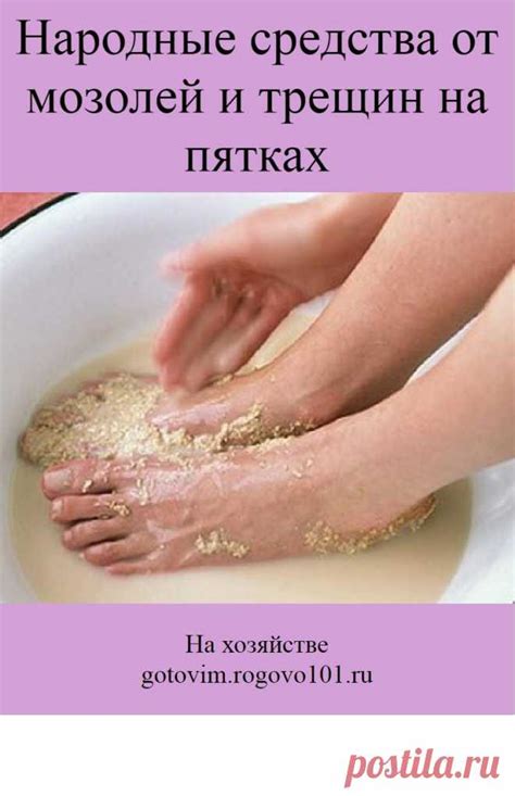 Народные рецепты избавления от мозолей