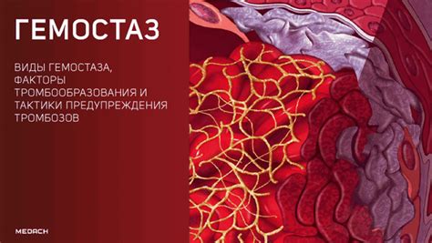 Нарушение гемостатического механизма