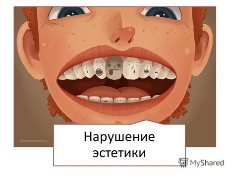 Нарушение эстетики