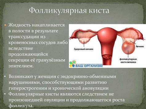 Наследование отсутствия левого яичника