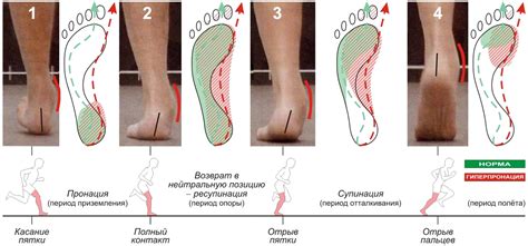 Наследственность и особенности строения стопы