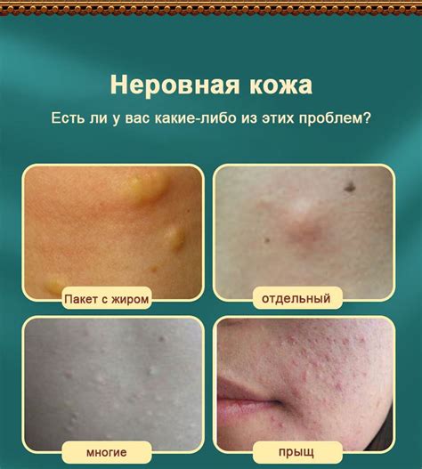 Натуральные ингредиенты для отечности на лице: борьба с припухлостью изнутри
