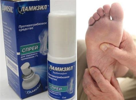 Натуральные средства борьбы с запахом в тапочках