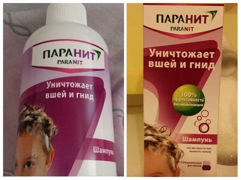 Натуральные средства против гнид
