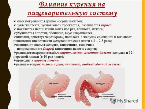 Негативное влияние пельменей на пищеварительную систему