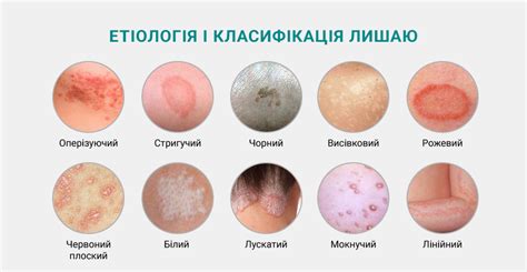 Негативные последствия применения детского крема для взрослых