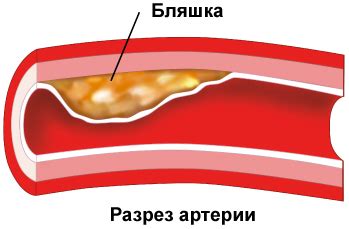 Недостаточное кровоснабжение и проблемы с сосудами