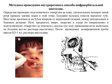 Неинвазивные способы обезболивания