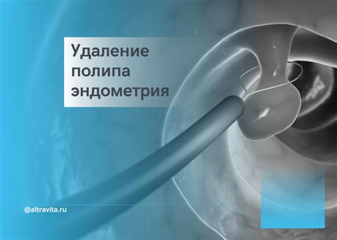 Неполное удаление полипа