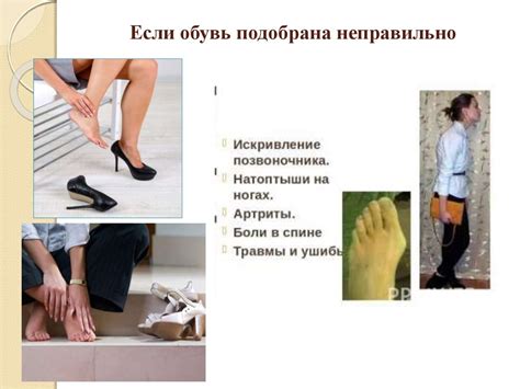 Неправильная обувь и ее влияние на стопу
