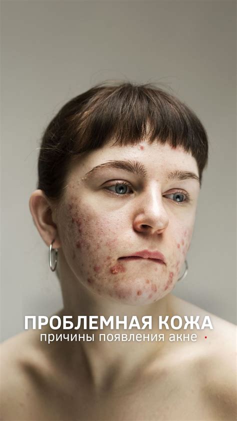 Неправильное использование или уход