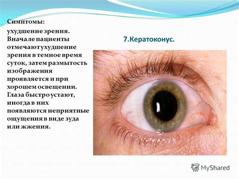 Неприятные состояния глаз