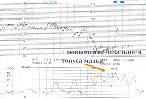 Низкая активность матки