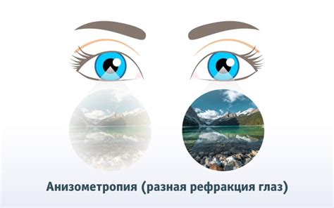 Обломовщина в глазах штольца
