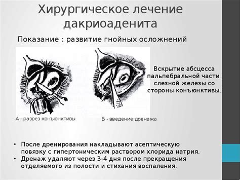 Образование гнойных осложнений