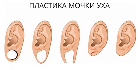Ожог мочки уха: опасность самостоятельного вмешательства