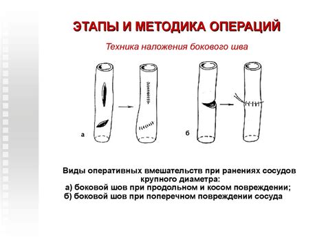 Опасность повреждения кровеносных сосудов