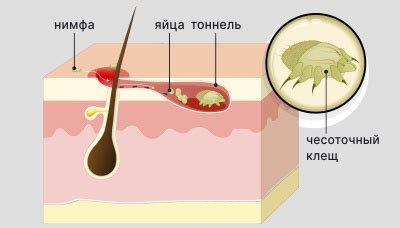 Определение клеща в организме человека